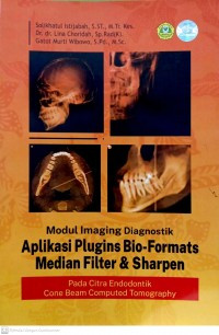 Image of Modul imaging diagnostik aplikasi plugins bio-format median filter dan sharpen pada citra endodontik cone beam computed tomography
