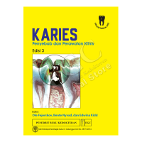 Image of Karies penyebab dan perawatan klinis