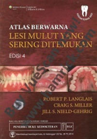 Image of ATLAS BERWARNA LESI MULUT YANG SERING DITEMUKAN
