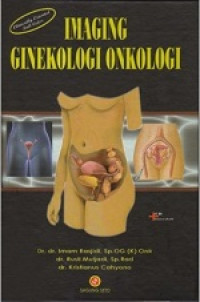 Image of Imaging ginekologi onkologi