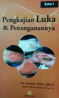 Image of Pengkajian Luka dan Penanganannya