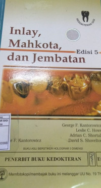 Image of Inlay mahkota dan jembatan