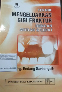 Image of Teknik mengeluarkan fraktur dengan mudah dan cepat