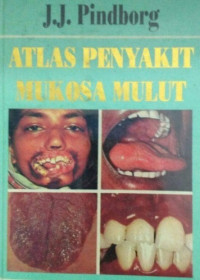 Image of Atlas penyakit mukosa mulut