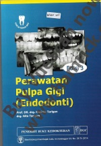 Image of Perawatan pulpa gigi (Endodonti)