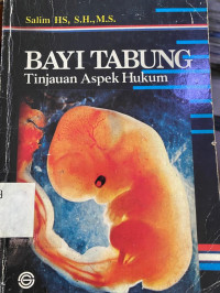 Image of Bayi Tabung Tijnjauan  Aspek Hukum