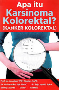 Image of Apa itu Karsinoma Kolorektal