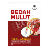 Image of Bedah mulut : Oral Surgery